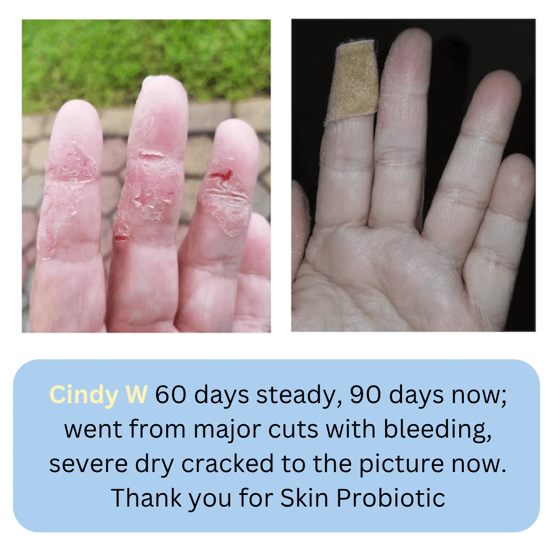 Chumgum SkinProbiotics Microbiome Skincare