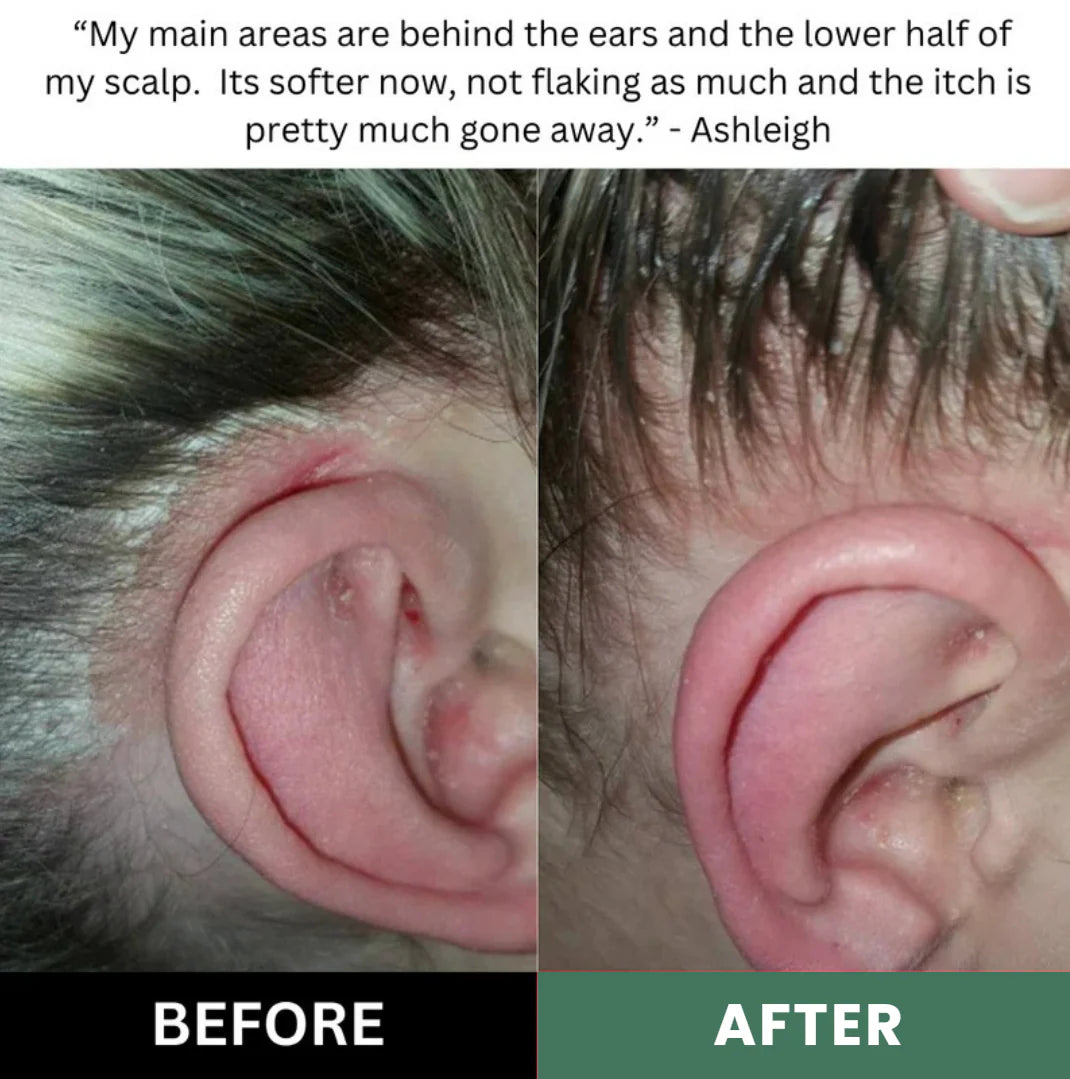 Chumgum Natural Scalp Scrub