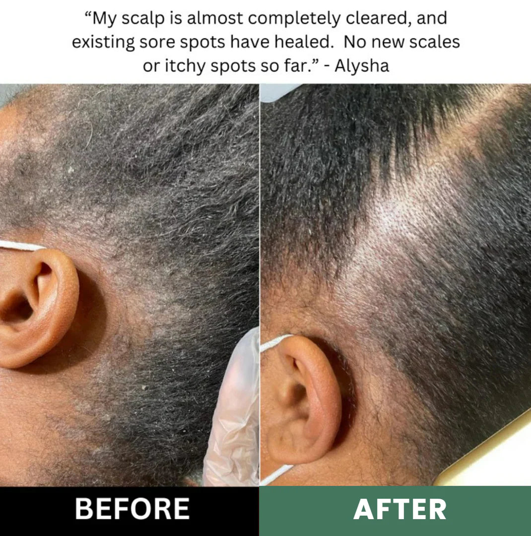 Chumgum Natural Scalp Scrub